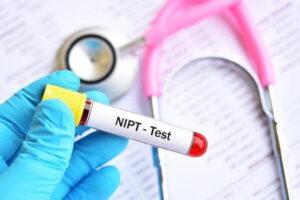 x&eacute;t nghiệm NIPT ở đ&acirc;u uy t&iacute;n